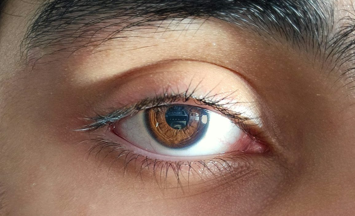 Top 3 Trending Dark Circle Treatments in Korea