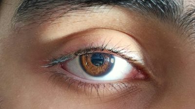 Top 3 Trending Dark Circle Treatments in Korea