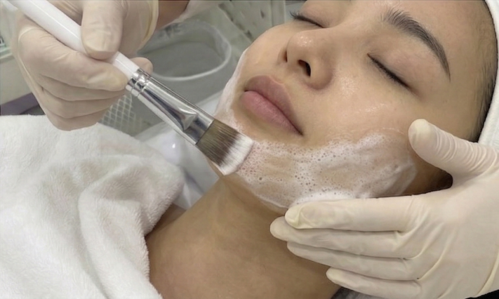 next-generation Peeling solution, XE-LHA PEEL