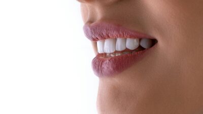 Upper Lip Lift Side Effects
