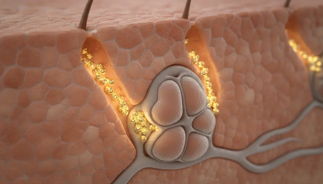 Gold nanoparticles target sebaceous glands to stop acne at its root.