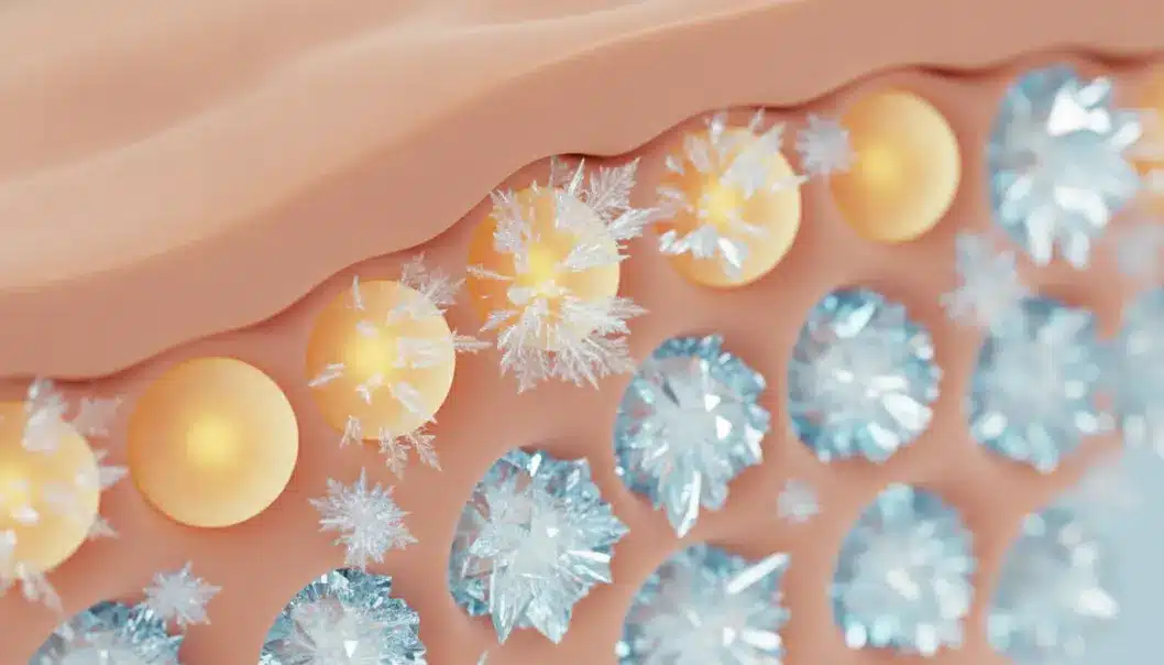 Clatuu utilizes cryolipolysis technology to safely freeze and destroy stubborn fat cells without harming surrounding tissues.