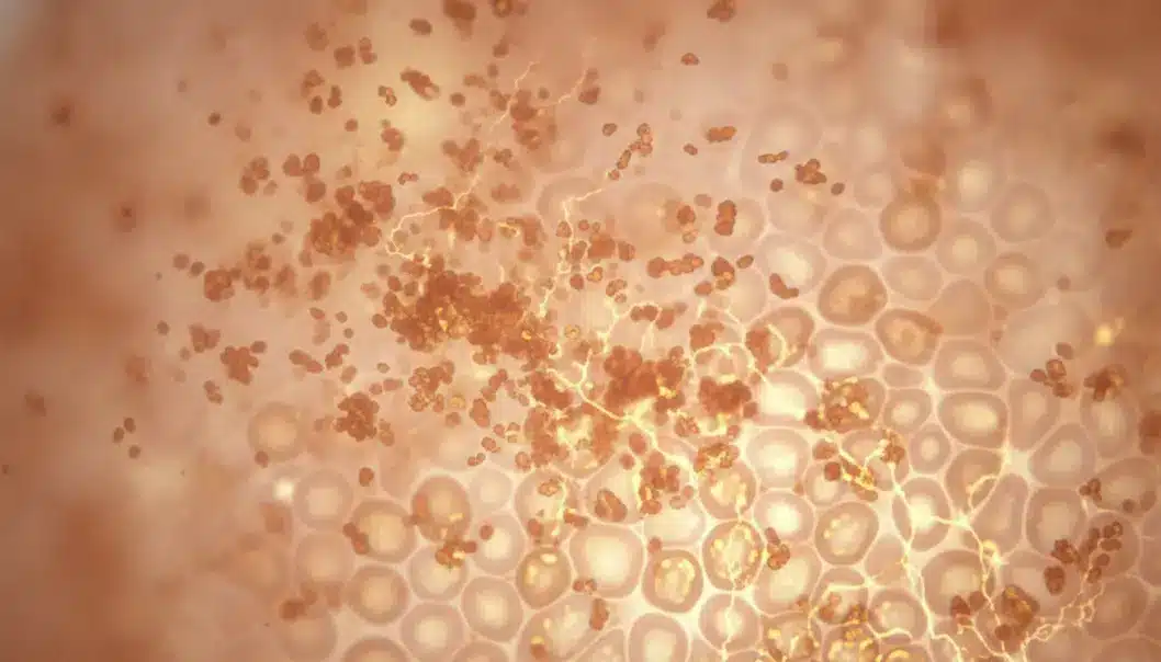 VRM3 toning breaks down deep-seated melanin into tiny particles that the body naturally eliminates.