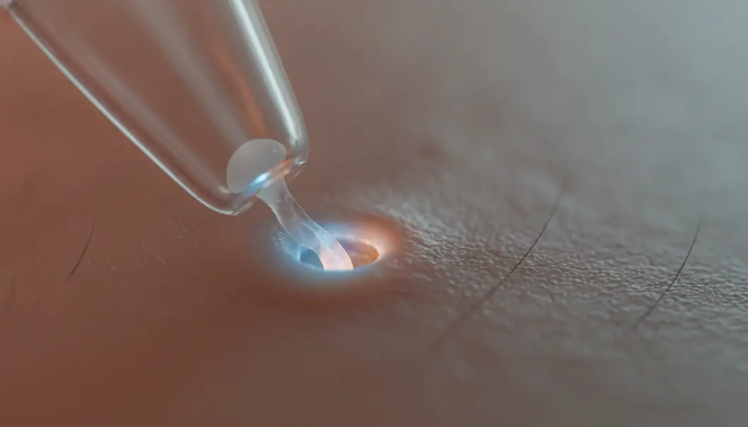 The dual-action technology of TheraClear combines gentle vacuum extraction with purifying light.