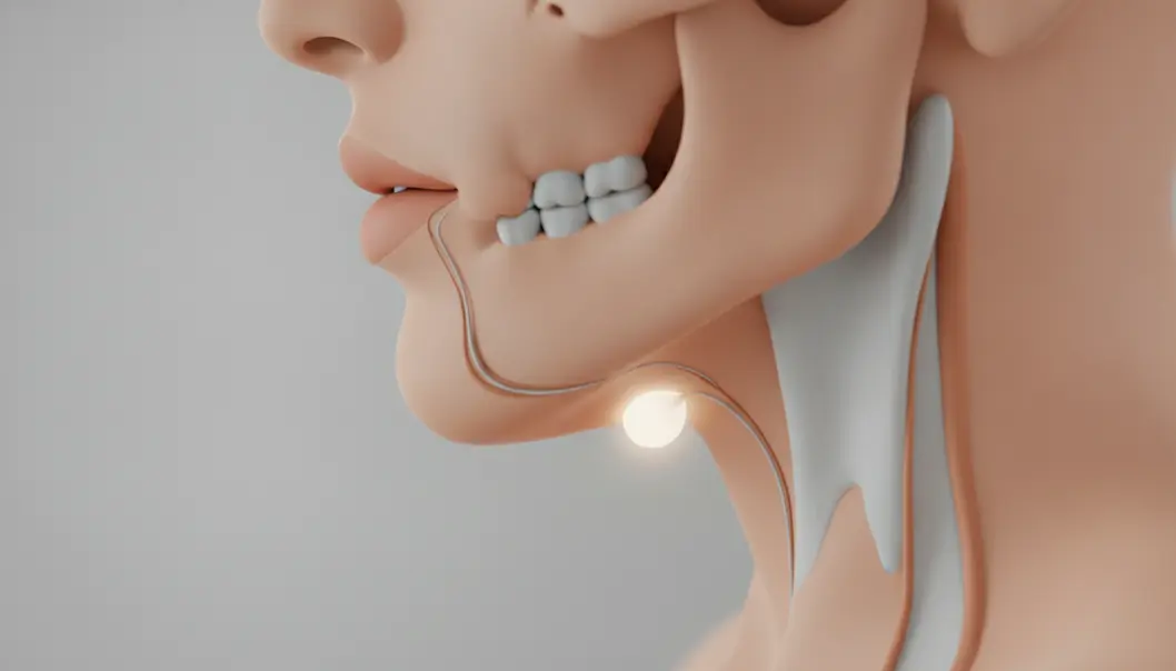 Understanding the location of the submandibular gland is key to treating jawline fullness.