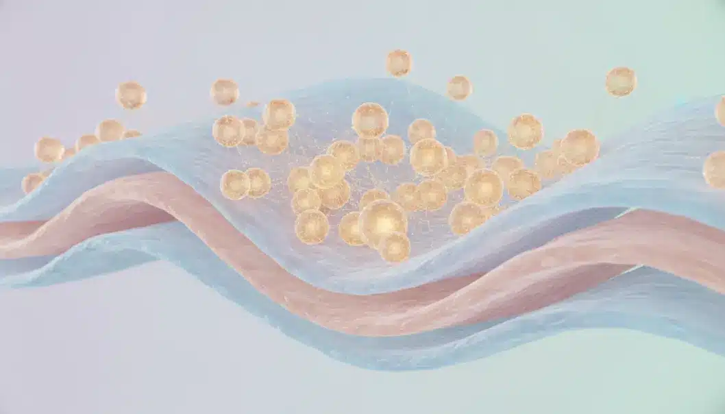 Ultracol uses microscopic PDO spheres to stimulate natural collagen production.