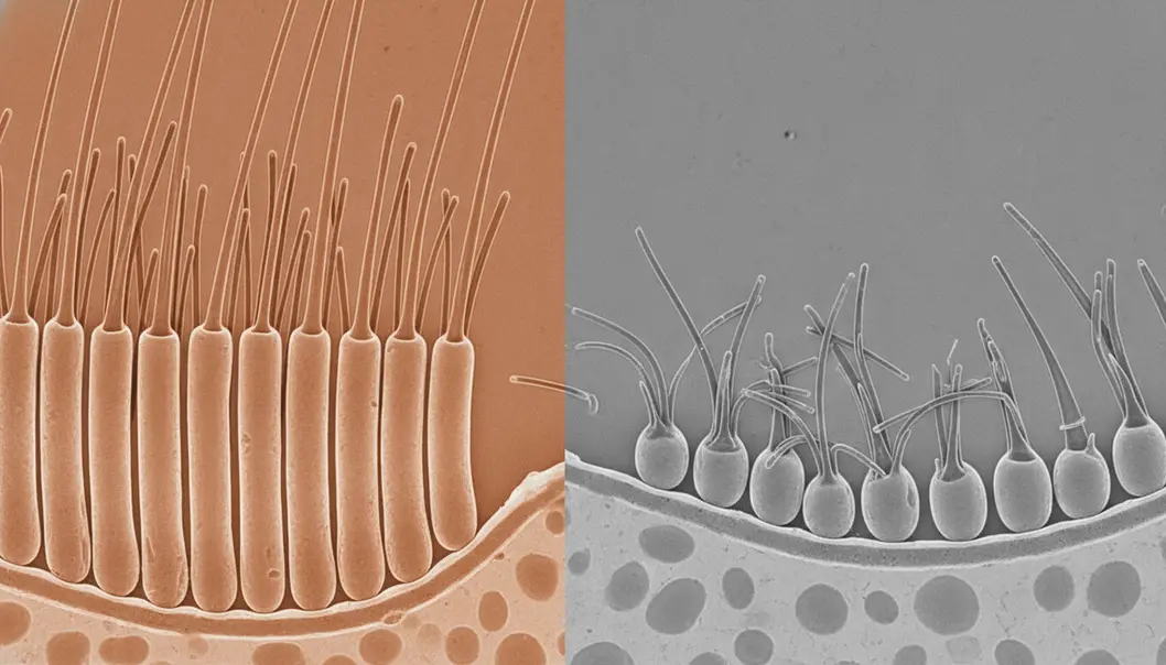 The stark contrast between healthy stereocilia and those damaged by loud noise.