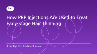 prp hair loss treatment korea — How PRP Injections Are Used to Treat Early-Stage Hair Thinning
