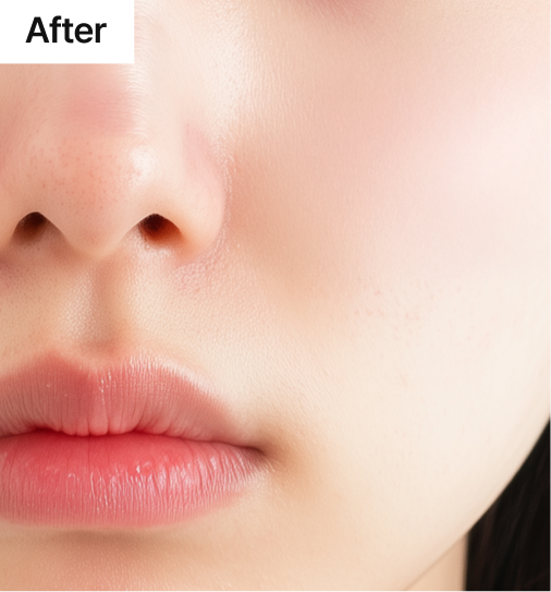 ララピール 効果