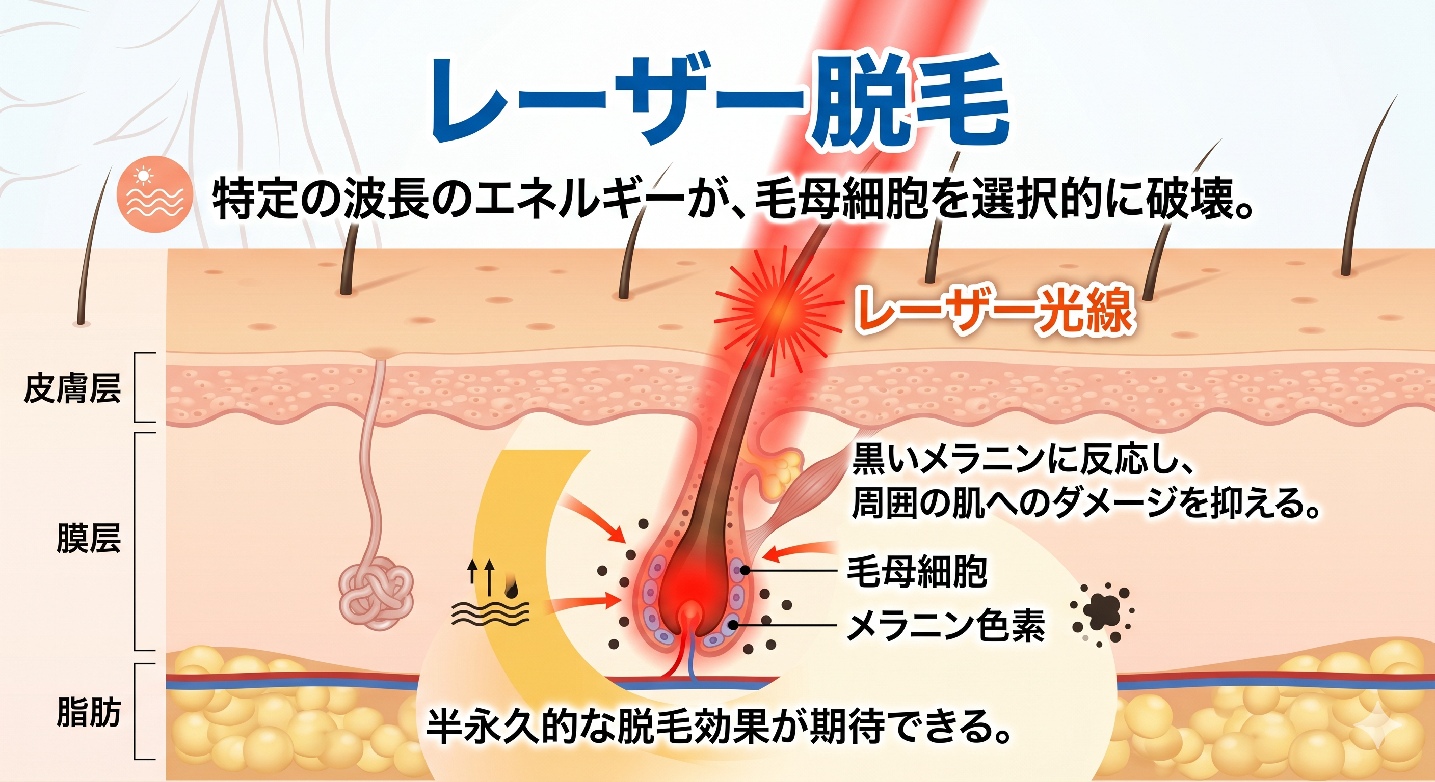 レーザー脱毛の効果・注意点総まとめ！失敗しない最安値予約