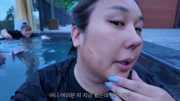 또간집 풍자도 반한 시술? 이중턱 고민, 인모드 해결! 효과/후기 총정리 3 2025061201559 0