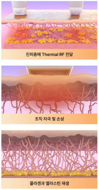 써펙트