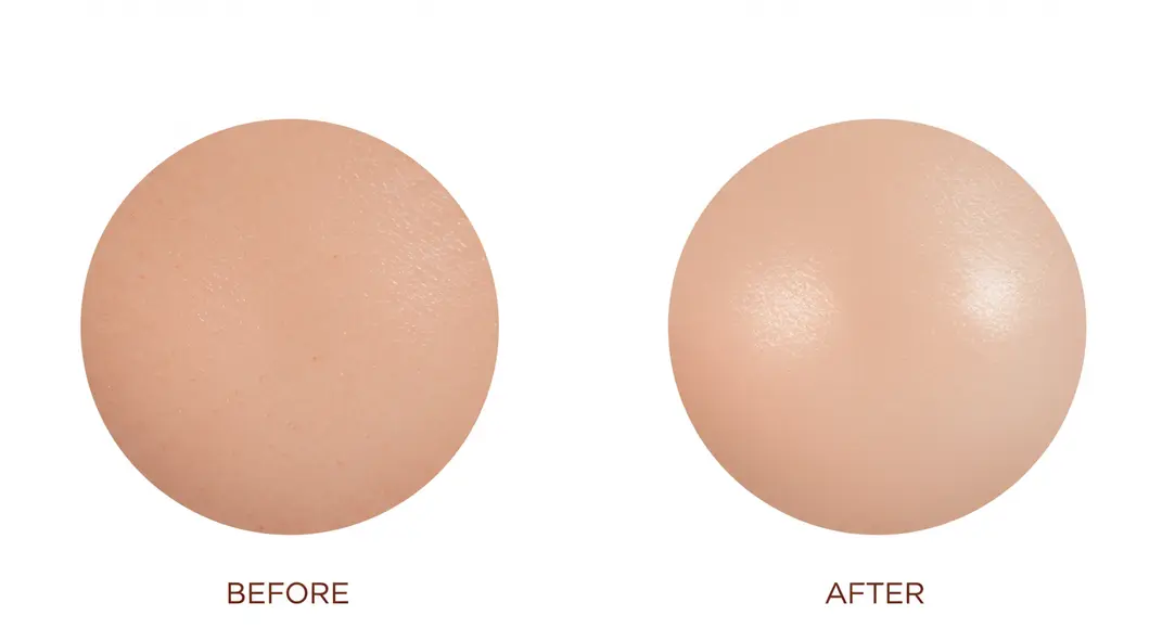 Visual representation of skin texture improvement after a hyaluronic acid skin booster treatment.