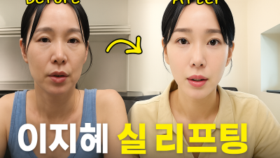 이지혜 실 리프팅