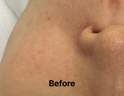 쎄라필 효과/가격 총정리: 자극 없는 광채 피부의 비밀 3 쎄라필 Before 1