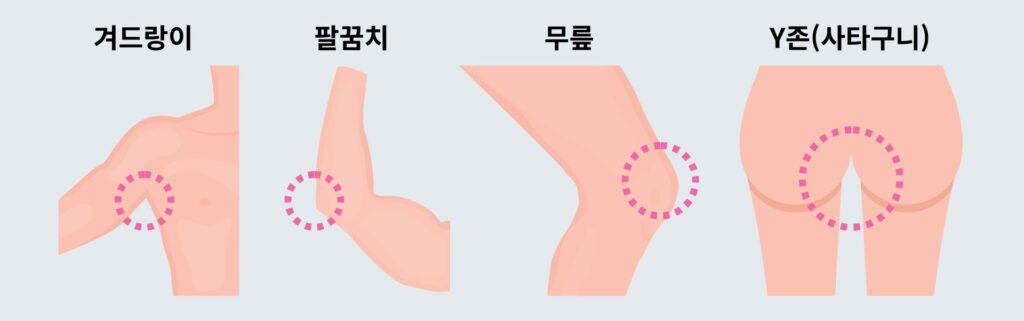 필링 쎄라와이_사용 가능 부위