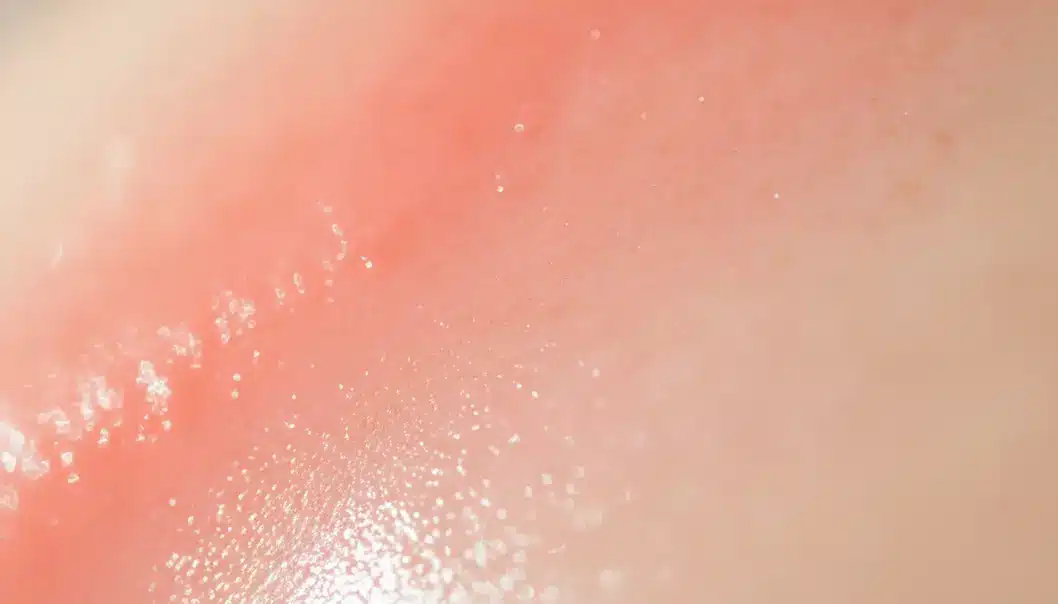 근본적인 피부 재생이 흉터와 모공 관리의 핵심입니다.