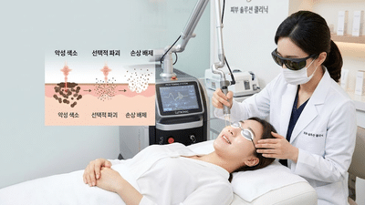 색소침착