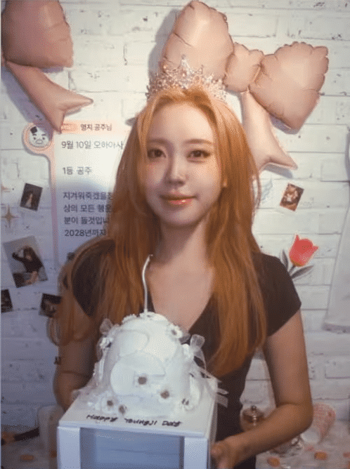 눈밑지방재배치, 최근 이영지도 경험한 리즈 갱신 비결! 피곤해 보이는 눈밑 다크서클 완전 탈출법 3 눈밑지방재배치