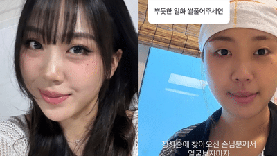 눈밑지방재배치, 최근 이영지도 경험한 리즈 갱신 비결!