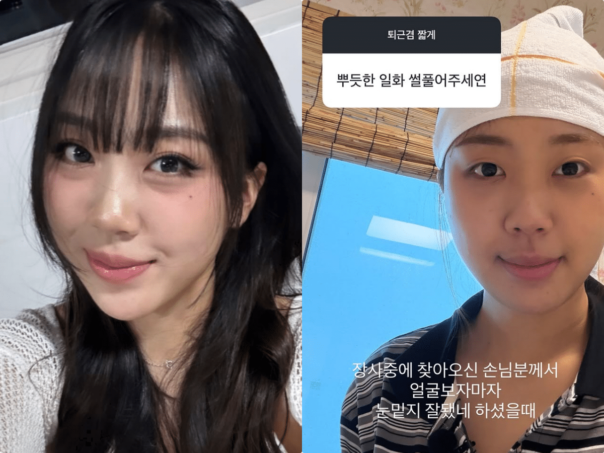 눈밑지방재배치, 최근 이영지도 경험한 리즈 갱신 비결!