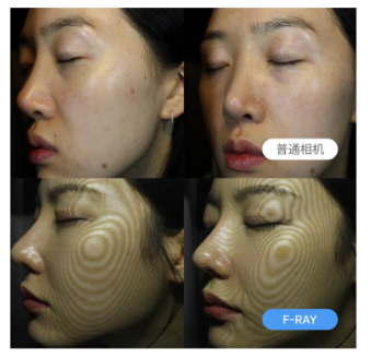 1万韩元就能做的皮肤精细检测!韩国最新皮肤诊断仪F-RAY活动价不容错过! 2 F RAY活动3