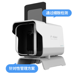 F RAY活动1