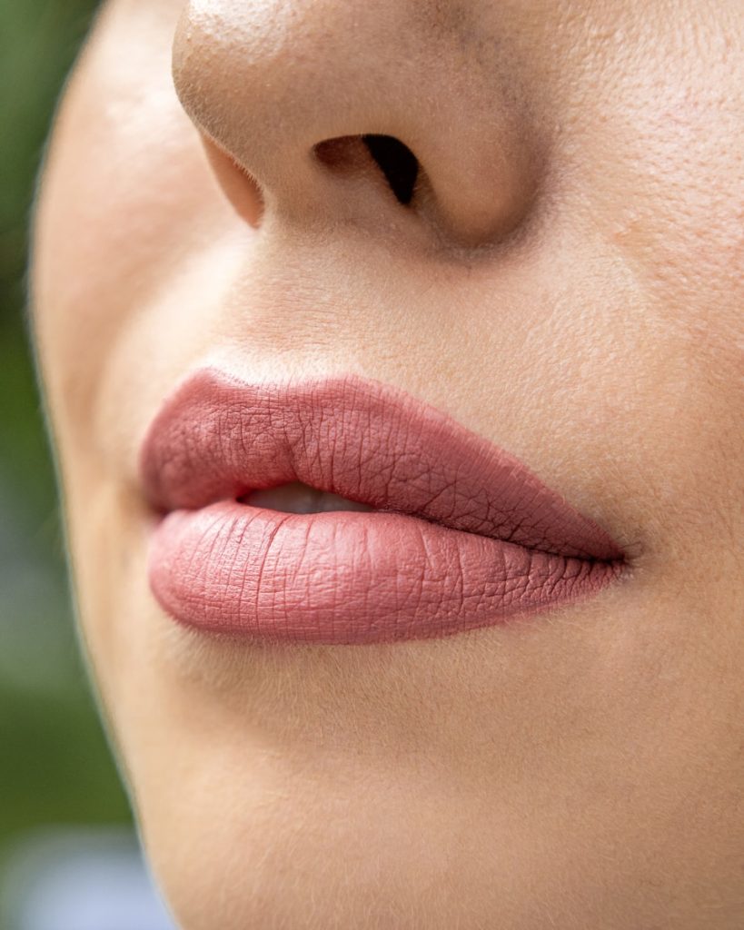 Lip Augmentation Surgery