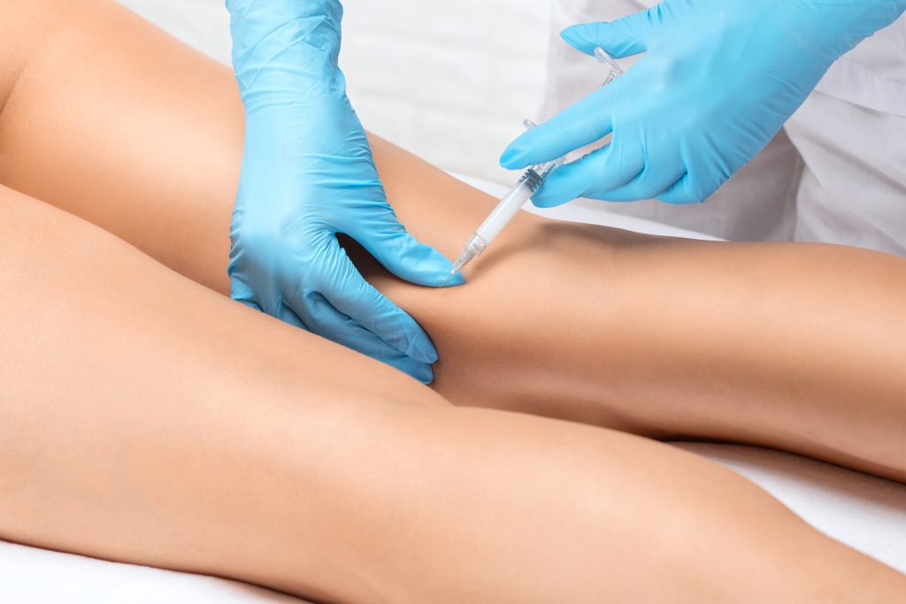 Calf Contouring Surgery