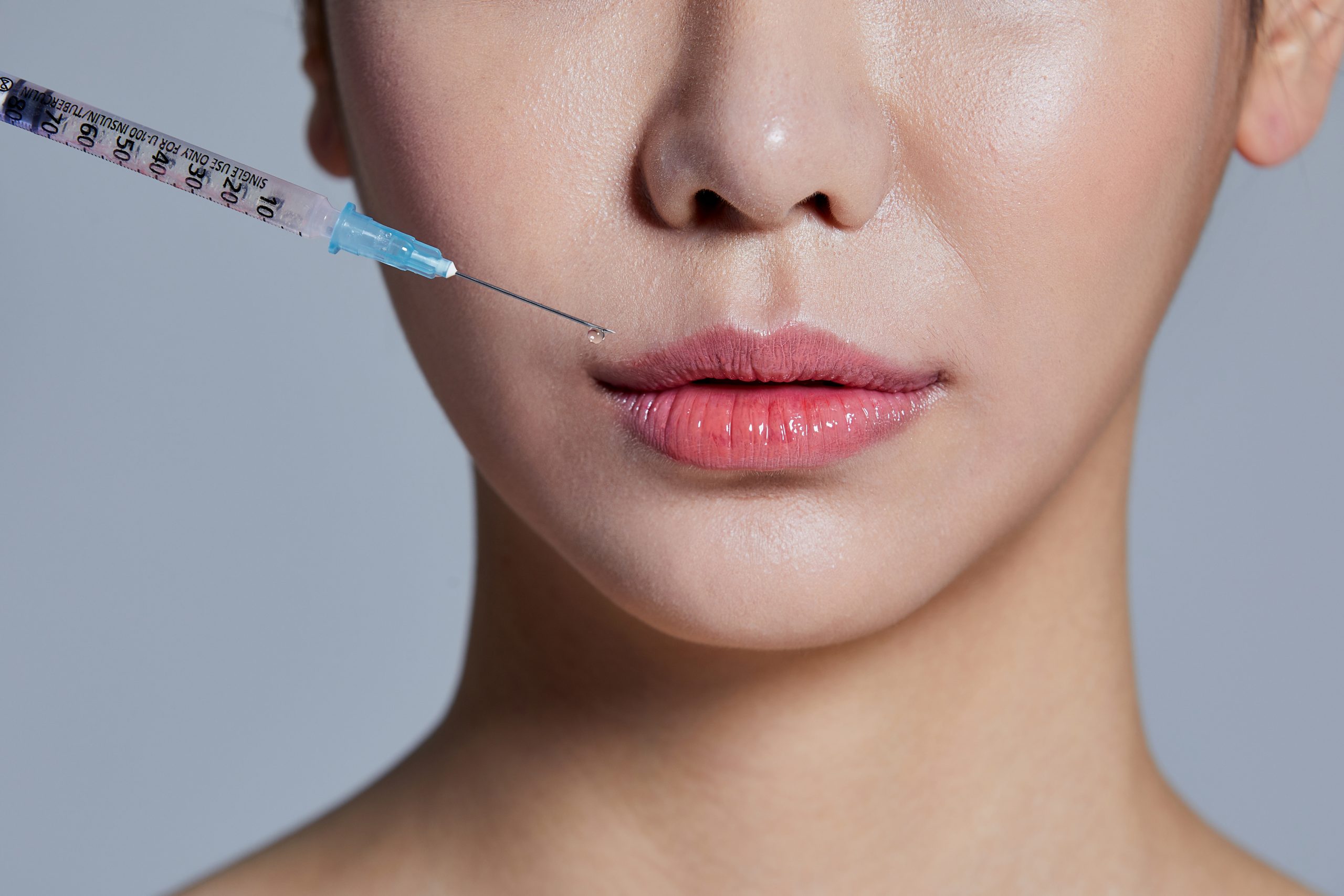 唇部填充 2 scaled