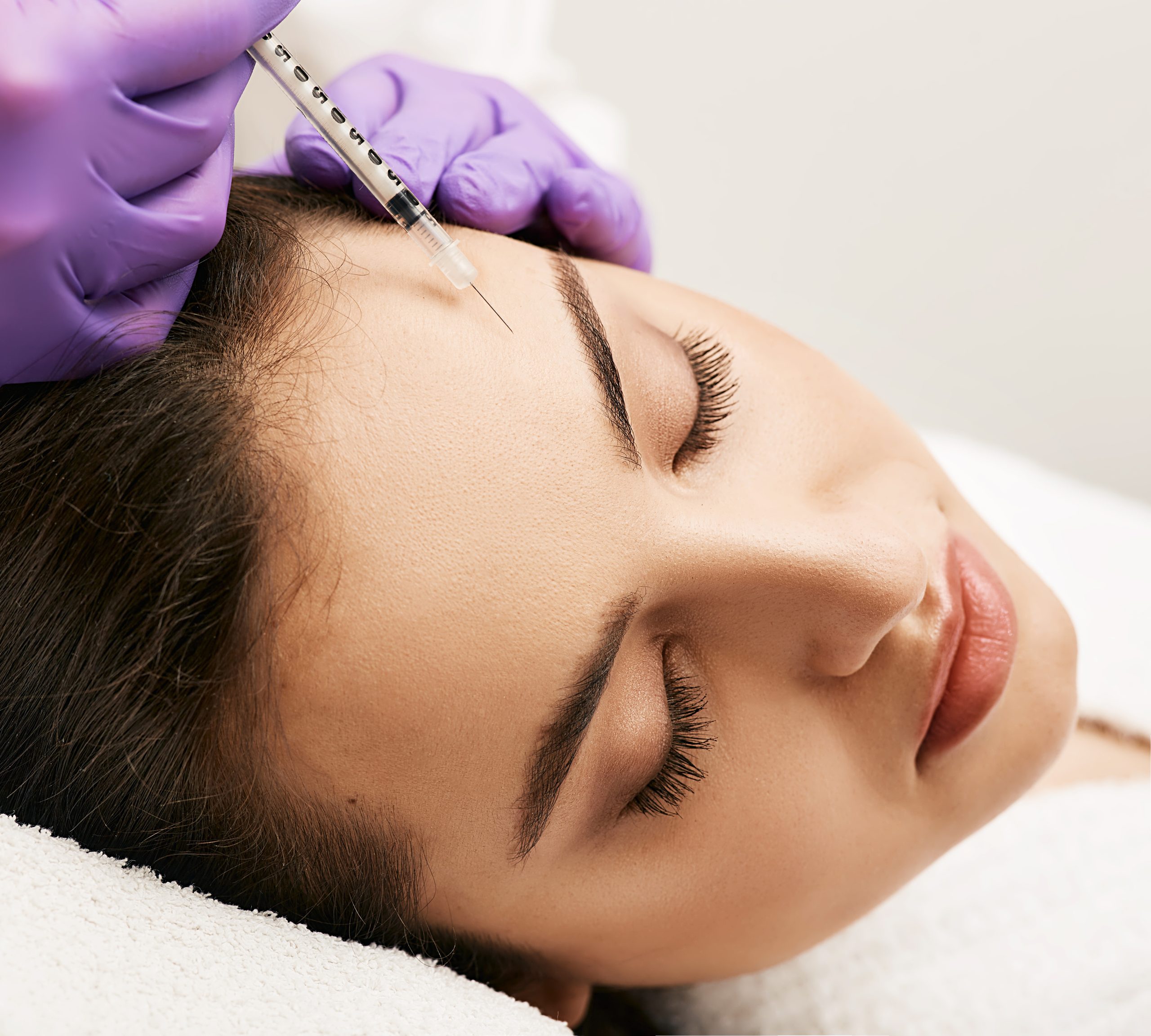 额头肉毒注射1 scaled