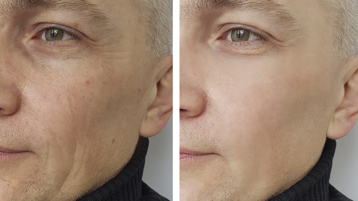 GettyImages 918073280