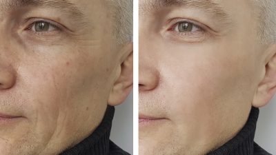 GettyImages 918073280