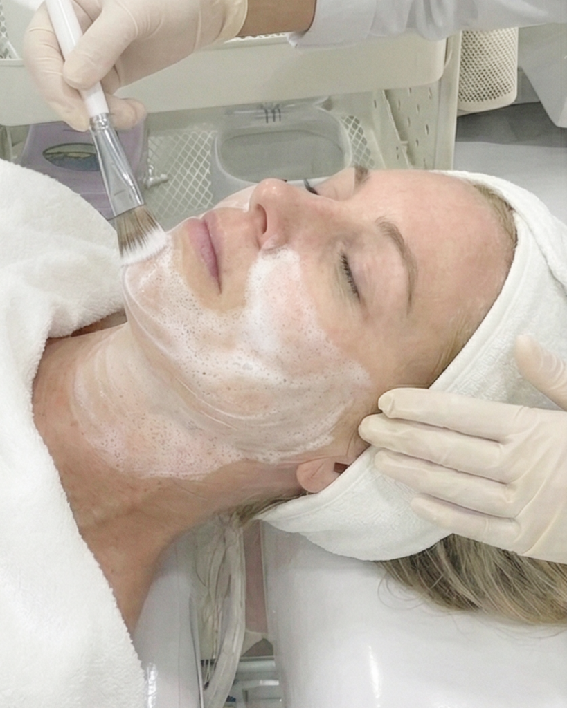 XE-LHA PEEL 膚屏障的第4代煥膚