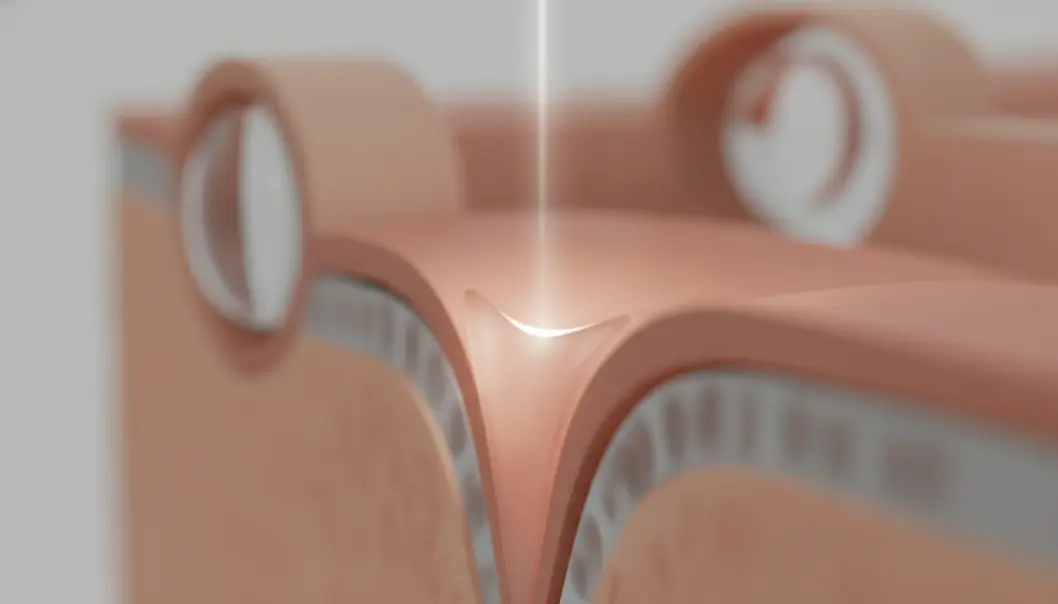 LASIK 手術透過高科技雷射精準重塑角膜，幫助患者快速恢復清晰視力。