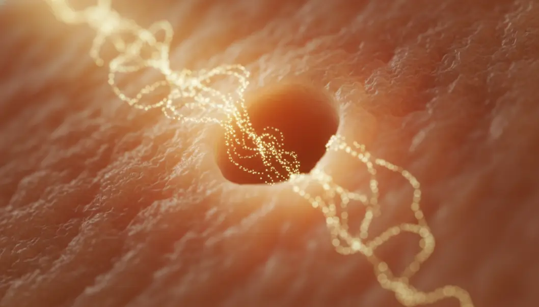 A visual representation of platinum nanoparticles and laser therapy working together to treat acne at the root.