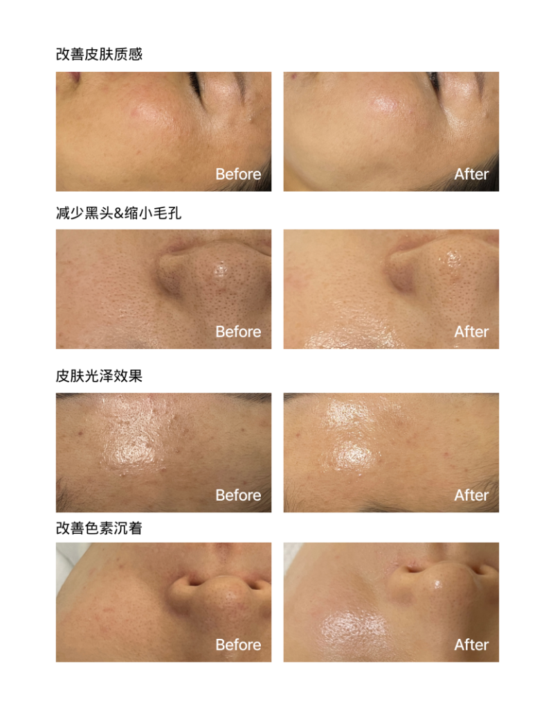 韩国明星都在做的XELHA光彩换肤:比果酸更有效1步达成美白干净水光肌 6 添加标题 1