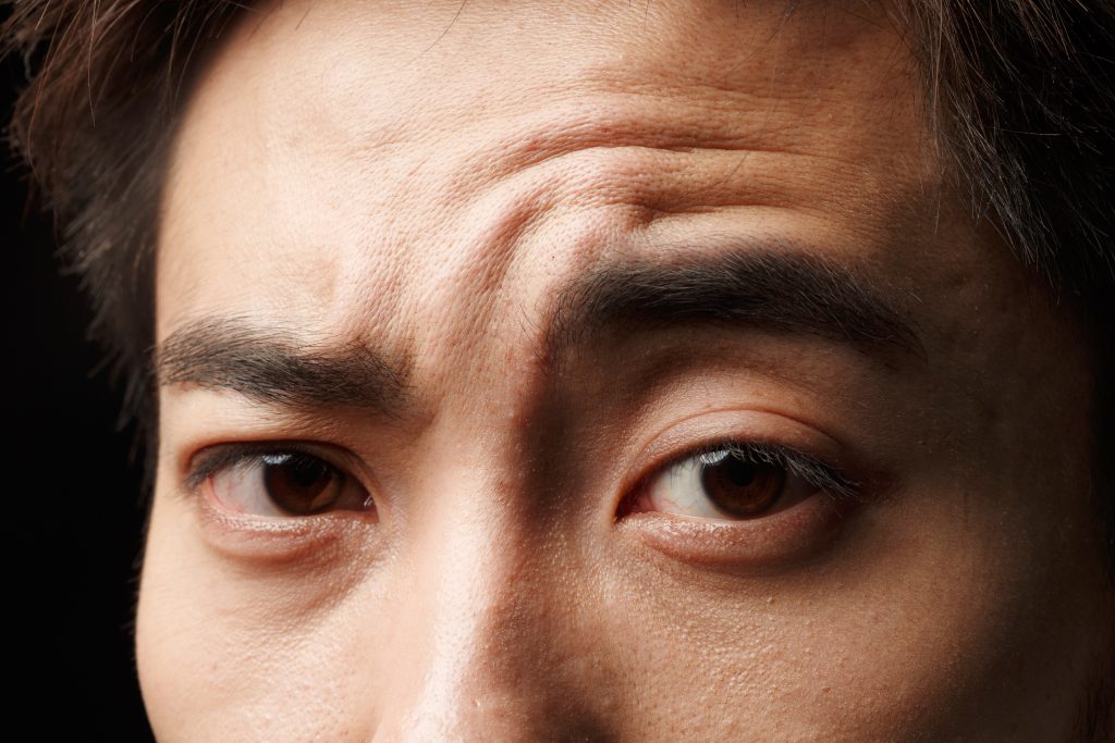 面部毛发移植术:精准塑造面部美感的整形之选 3 GettyImages vs12422551