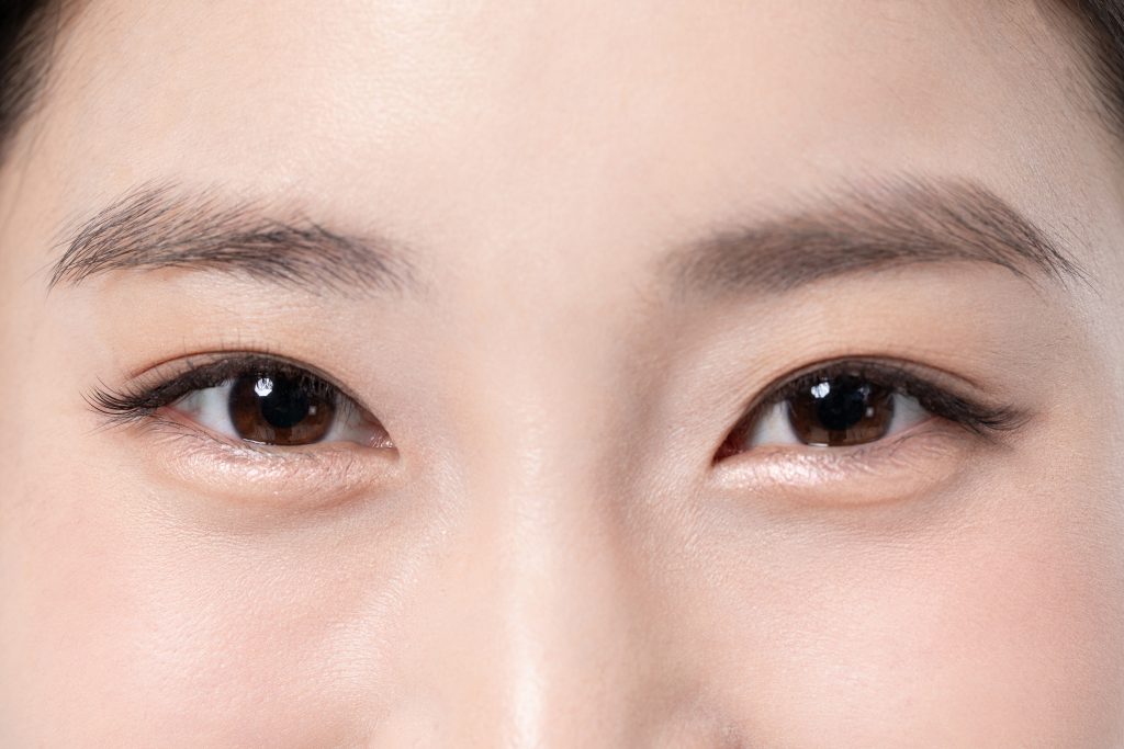 上下眼睑整形:眼部整形不愧是韩国医美土特产,真的很自然! 2 上下眼睑整形1