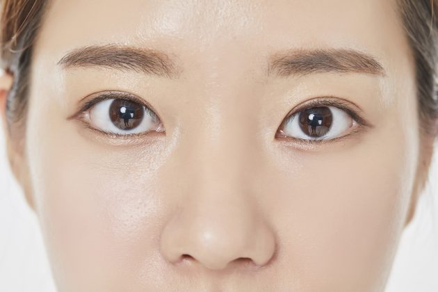 还我妈生鼻!韩国隆鼻修复效果自然,2月后侧脸绝了! 4 鼻